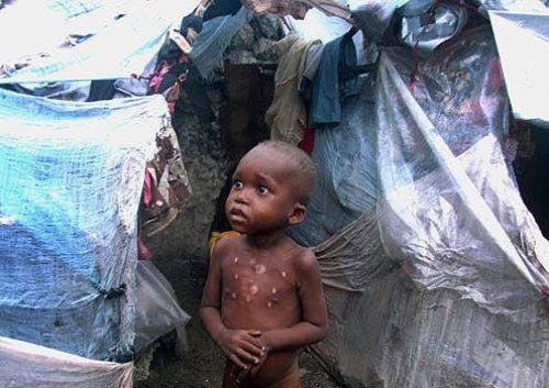 Somali dünyanın en feci felaketini yaşıyor