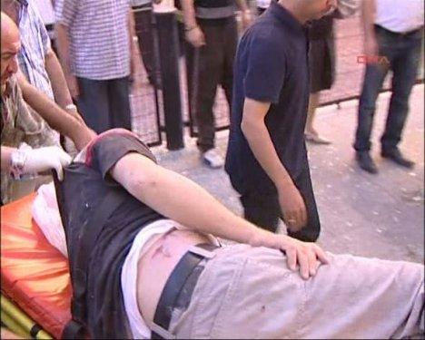 Ankara'da patlama - Resim 3