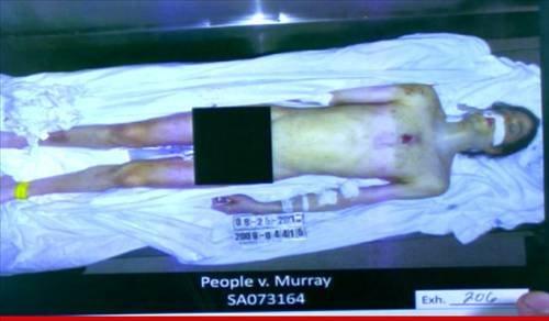 Michael Jackson'ın otopsi fotoğrafları yayınlandı