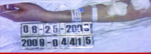 Michael Jackson'ın otopsi fotoğrafları yayınlandı