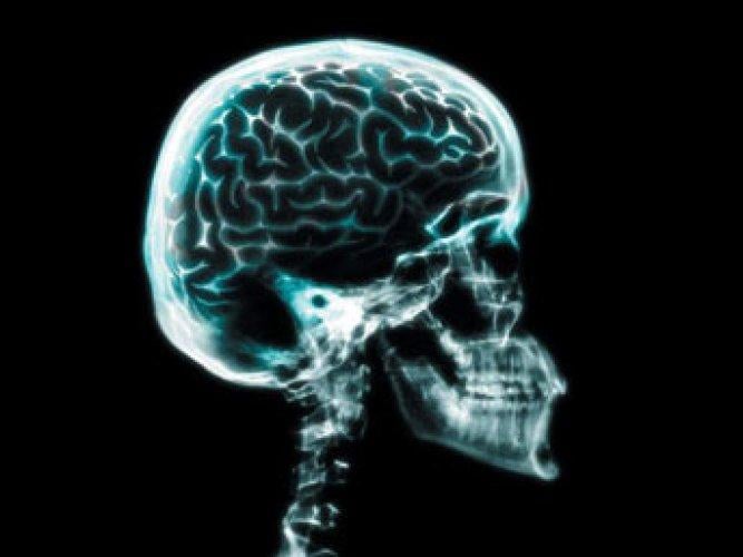 Tesadüfen bulunan icatlar