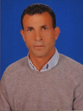 Türkiye'nin ilk yüz nakli ameliyatı - Resim 14