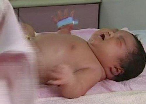 Çin'de 7 kiloluk bebek dünyaya geldi - Resim 4