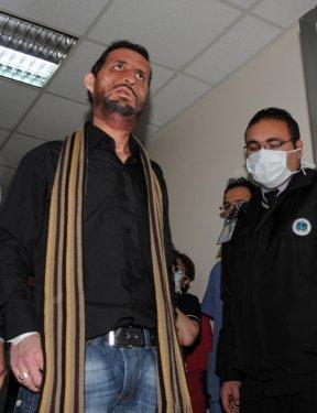İlk yüz nakli yapılan Acar kameralar karşısında - Resim 9