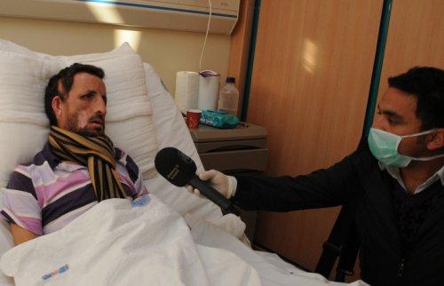 İlk yüz nakli yapılan Acar kameralar karşısında - Resim 17