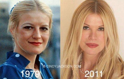 Ünlülerin estetik öncesi ve sonrası