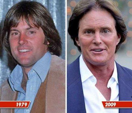 Ünlülerin estetik öncesi ve sonrası