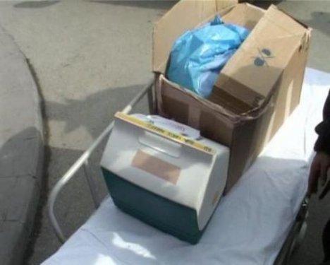 2. yüz nakli gerçekleştirildi