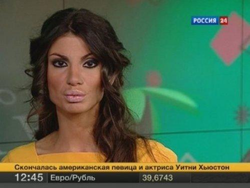 Rusya'da yeni moda Angelina dudağı  - Resim 6