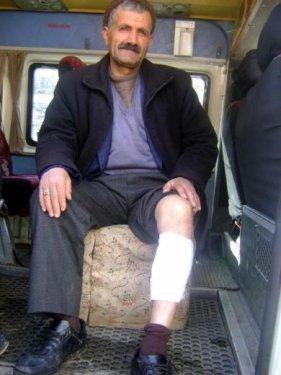 Kurdun kafasını taşla ezerek kurtuldu - Resim 3