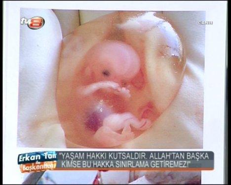 Melih Gökçek cenin fotoğrafları gösterdi