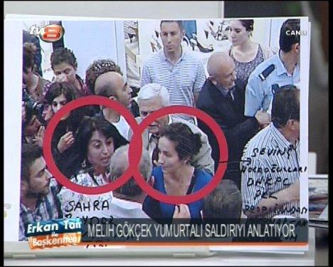 Melih Gökçek cenin fotoğrafları gösterdi