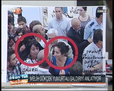 Melih Gökçek cenin fotoğrafları gösterdi