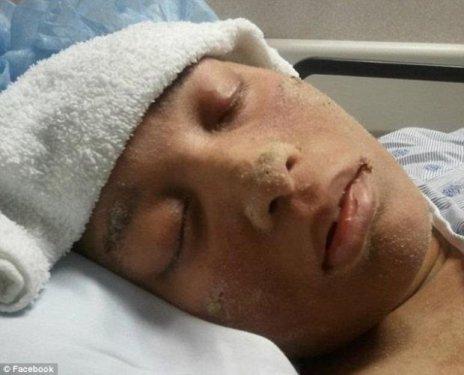 Cildinde tüy yerine tırnak çıkıyor 