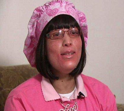 Cildinde tüy yerine tırnak çıkıyor 