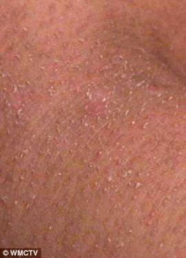 Cildinde tüy yerine tırnak çıkıyor 