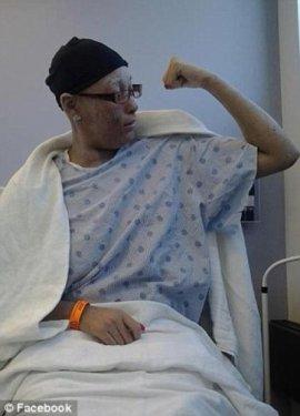 Cildinde tüy yerine tırnak çıkıyor 