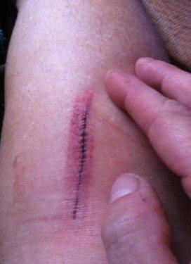 Ünlü yıldız Ağrı'da ölümden döndü 