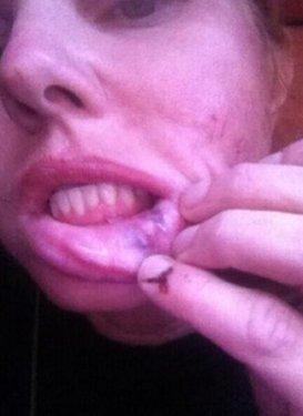 Ünlü yıldız Ağrı'da ölümden döndü 