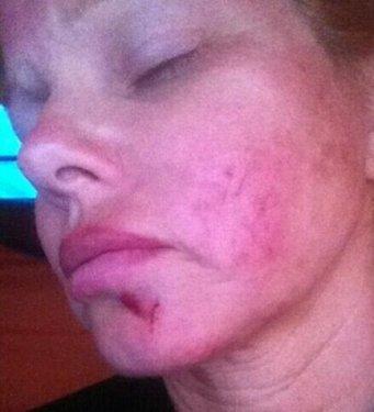 Ünlü yıldız Ağrı'da ölümden döndü 