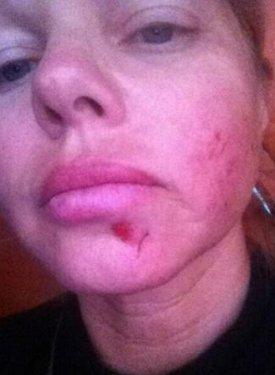 Ünlü yıldız Ağrı'da ölümden döndü 