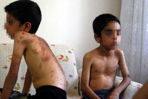 Bingöl'de şeker toplamaya giden çocuklara işkence