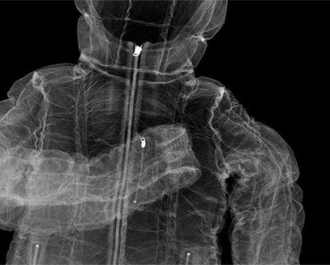 Fotoğrafçının bakış açısı