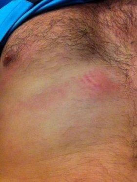 Serhat Akın çekiçle saldırdı