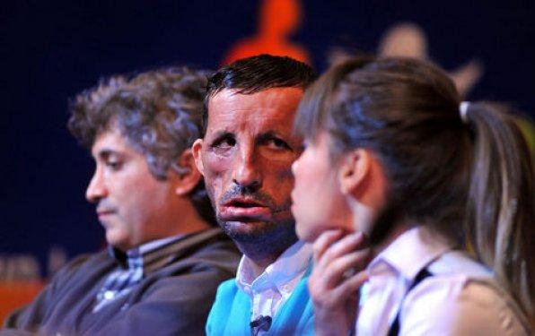 Aylar sonra Uğur Acar'ın yeni yüzü