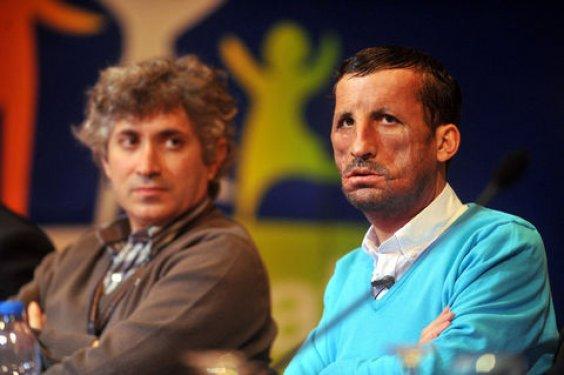 Aylar sonra Uğur Acar'ın yeni yüzü