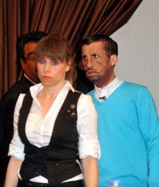 Aylar sonra Uğur Acar'ın yeni yüzü