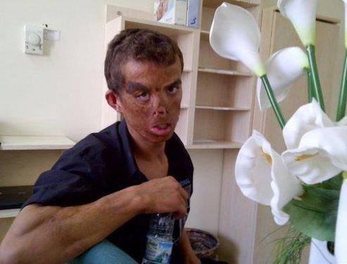 Aylar sonra Uğur Acar'ın yeni yüzü