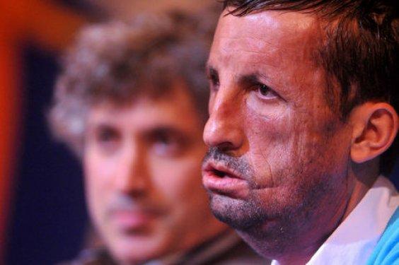 Aylar sonra Uğur Acar'ın yeni yüzü