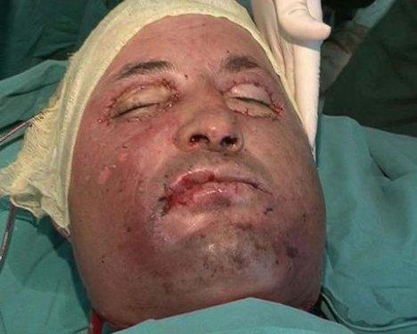 Aylar sonra Uğur Acar'ın yeni yüzü