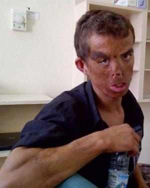 Aylar sonra Uğur Acar'ın yeni yüzü