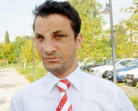 Aylar sonra Uğur Acar'ın yeni yüzü