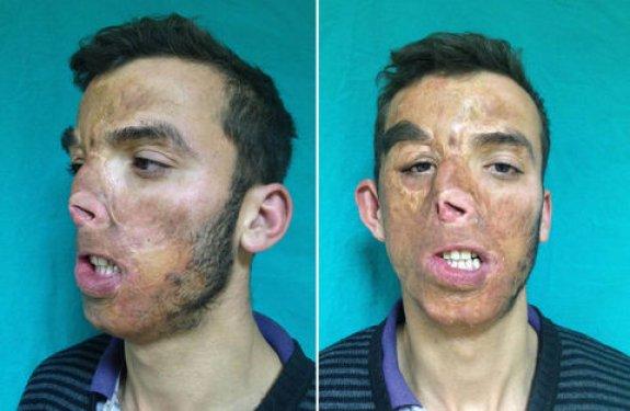 Aylar sonra Uğur Acar'ın yeni yüzü