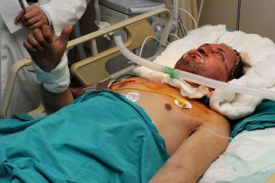 Aylar sonra Uğur Acar'ın yeni yüzü