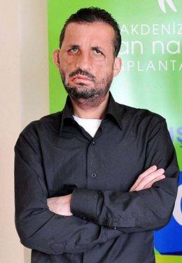 Aylar sonra Uğur Acar'ın yeni yüzü