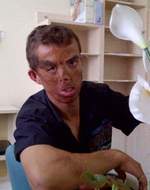 Aylar sonra Uğur Acar'ın yeni yüzü