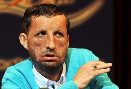 Aylar sonra Uğur Acar'ın yeni yüzü