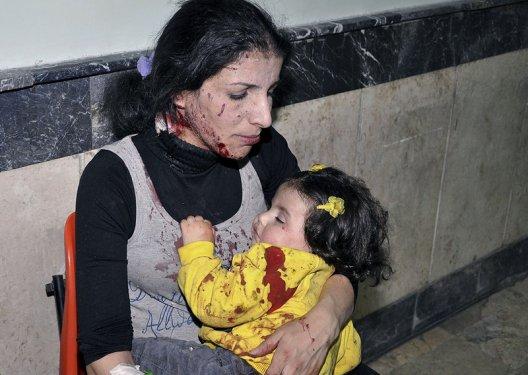 Suriye'deki savaşın kanlı yüzü