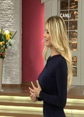 Songül Karlı'nın silikonlu dudakları kapanmıyor