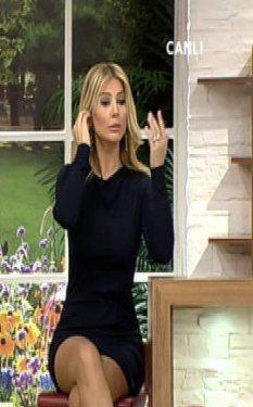 Songül Karlı'nın silikonlu dudakları kapanmıyor