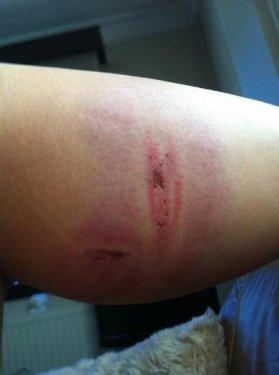 Gezi Parkı eylemcisi hastanelik oldu