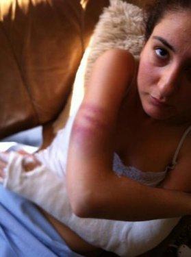 Gezi Parkı eylemcisi hastanelik oldu