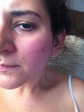 Gezi Parkı eylemcisi hastanelik oldu