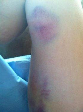 Gezi Parkı eylemcisi hastanelik oldu