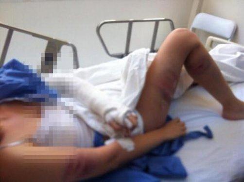 Gezi Parkı eylemcisi hastanelik oldu