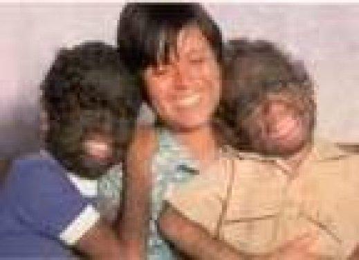 Dünyadaki en garip hastalıklar